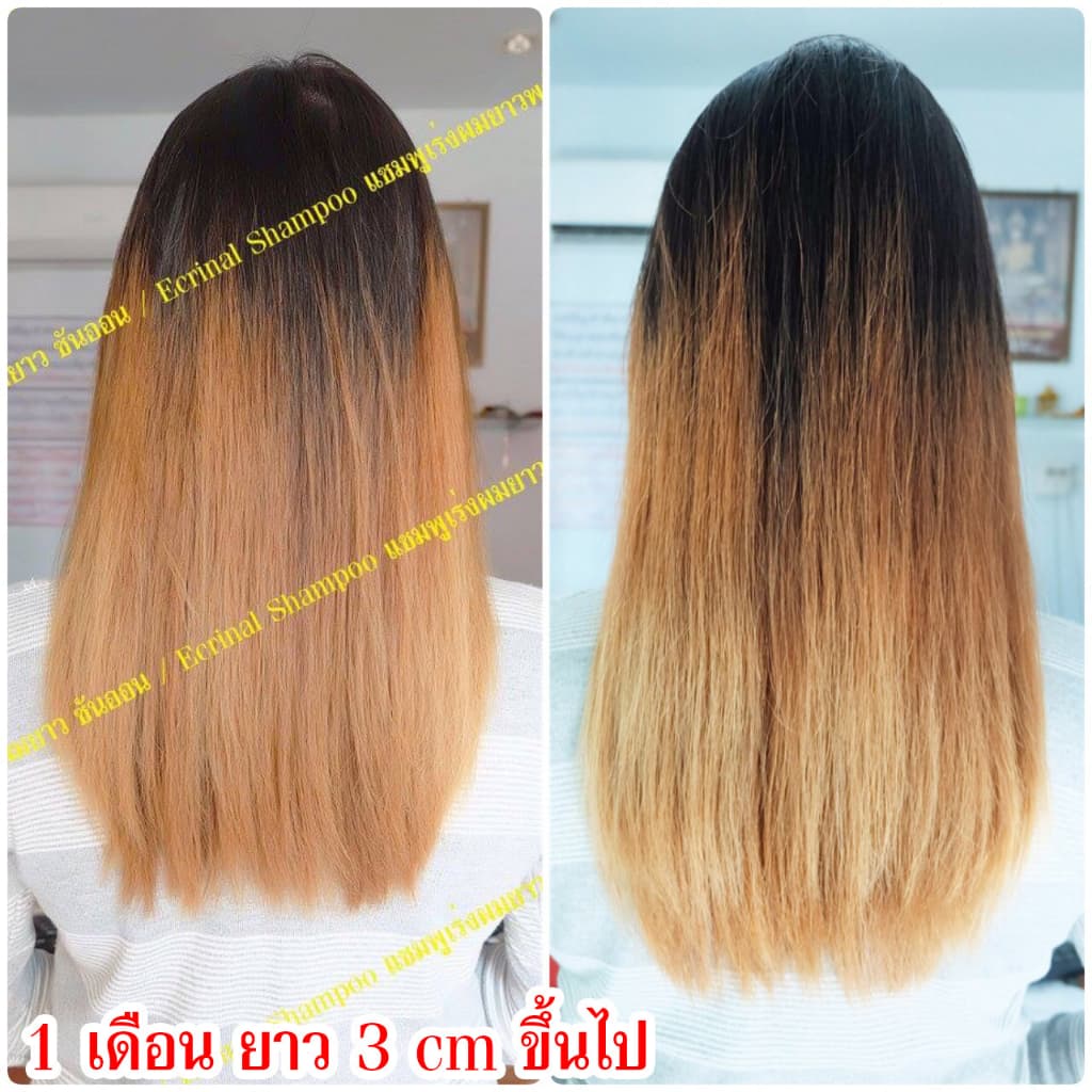 !! !! แชมพูเร่งผมยาวพลังม้า เฟอรินอล แชมพูเร่งผมยาว เห็นผลทันที!! เพียงแค่ขวดแรกที่ใช้ รูปที่ 4
