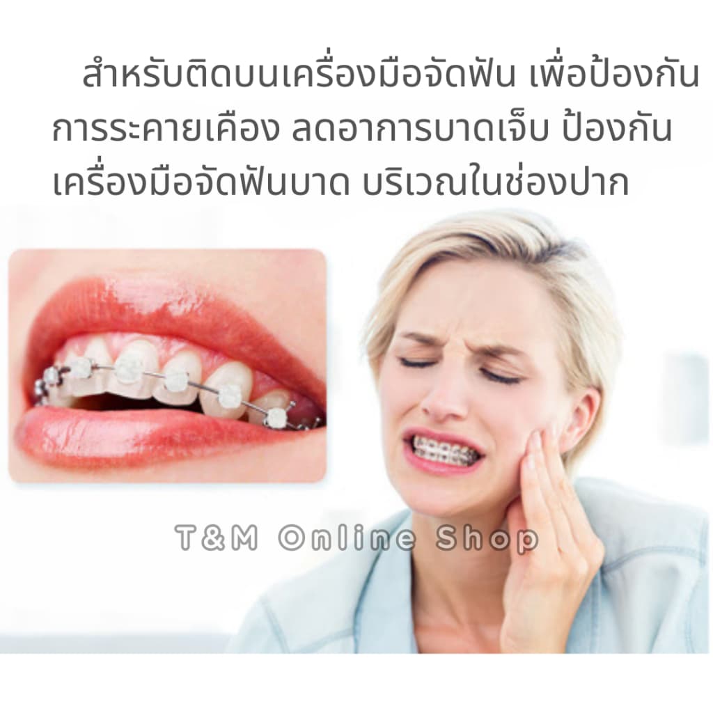 ขี้ผึ้งสำหรับคนจัดฟัน เลือกกลิ่นได้ ลดการระคายเคืองจากเครื่องมือจัดฟัน แว๊กซ์ขี้ผึ้ง 1ตลับมี5แท่ง รูปที่ 2