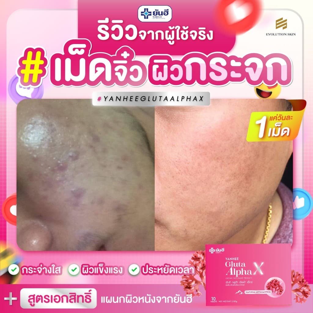 YANHEE Gluta AlphaX ยันฮีกลูต้า อัลฟ่า เอ็กซ์ วิตามินผิว ช่วยปรับผิวขาวใส ออร่า ลดจุดด่างดำ ฝ้า กระ รูปที่ 7
