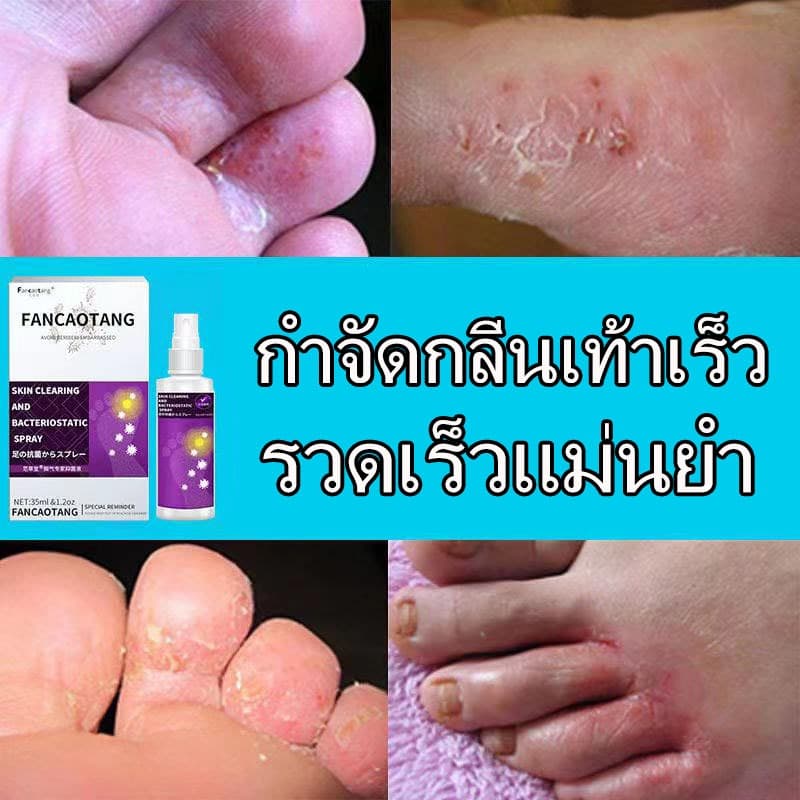 สเปรย์ดับกลิ่นเท้า น้ำยาดับกลิ่นเท้า สเปรย์ดับกลิ่นรองเท้าและฆ่าเชื้อแบคทีเรีย รูปที่ 7