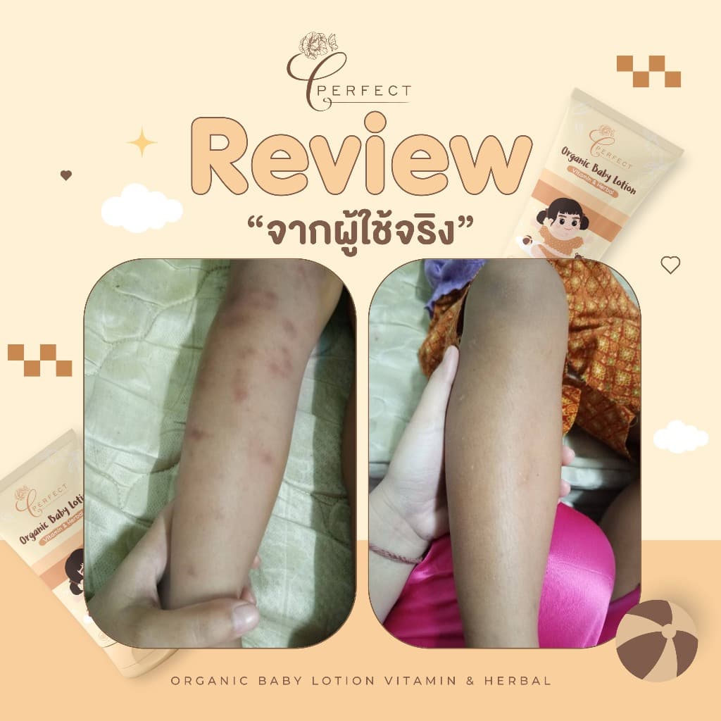 PERFECT โลชั่นเด็กออร์แกนิค บำรุงผิวขาวกระจ่างใส แก้ขาลาย ลดรอยยุงกัด กู้ผิวคล้ำเสีย รูปที่ 3