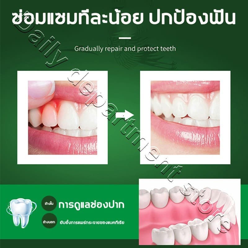 YIMIWEILAI แก้ปวดฟัน เหงือกอักเสบ ใช้หมดก็เห็นผล ช่วยลดอาการเจ็บฟันได้เป็นอย่างดี สเปรย์พ่นคอ ปวดฟัน สเปรย์แก้ปวดฟัน รูปที่ 9