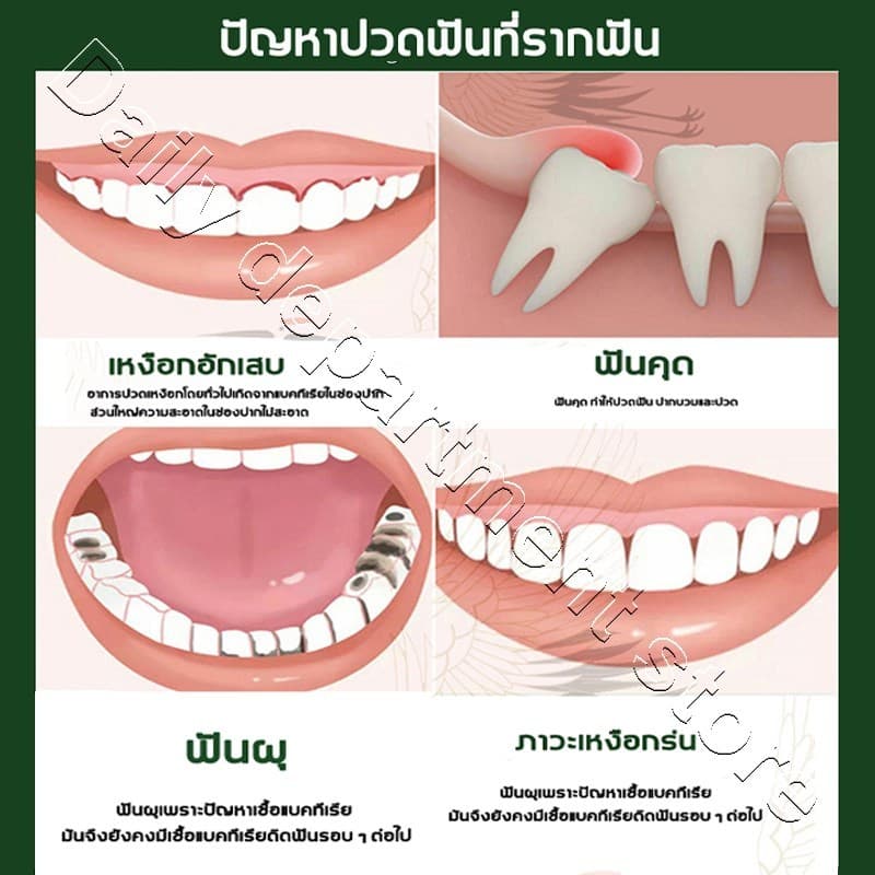 YIMIWEILAI แก้ปวดฟัน เหงือกอักเสบ ใช้หมดก็เห็นผล ช่วยลดอาการเจ็บฟันได้เป็นอย่างดี สเปรย์พ่นคอ ปวดฟัน สเปรย์แก้ปวดฟัน รูปที่ 3