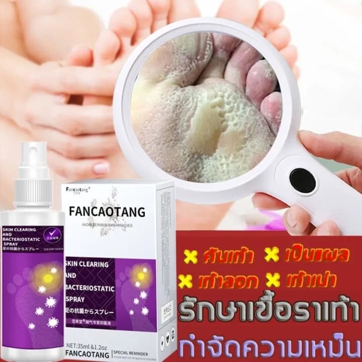 สเปรย์ดับกลิ่นเท้า น้ำยาดับกลิ่นเท้า สเปรย์ดับกลิ่นรองเท้าและฆ่าเชื้อแบคทีเรีย รูปที่ 1