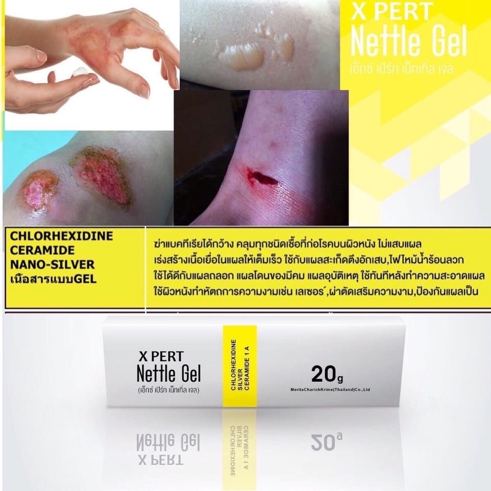Fullext Ointment / Lobenate Invigorate Skin Gel / Dermiskin 30g Skin Ointment / Lobenate คัน ผิวอักเสบ แผลสด แผลกดทับ รูปที่ 9