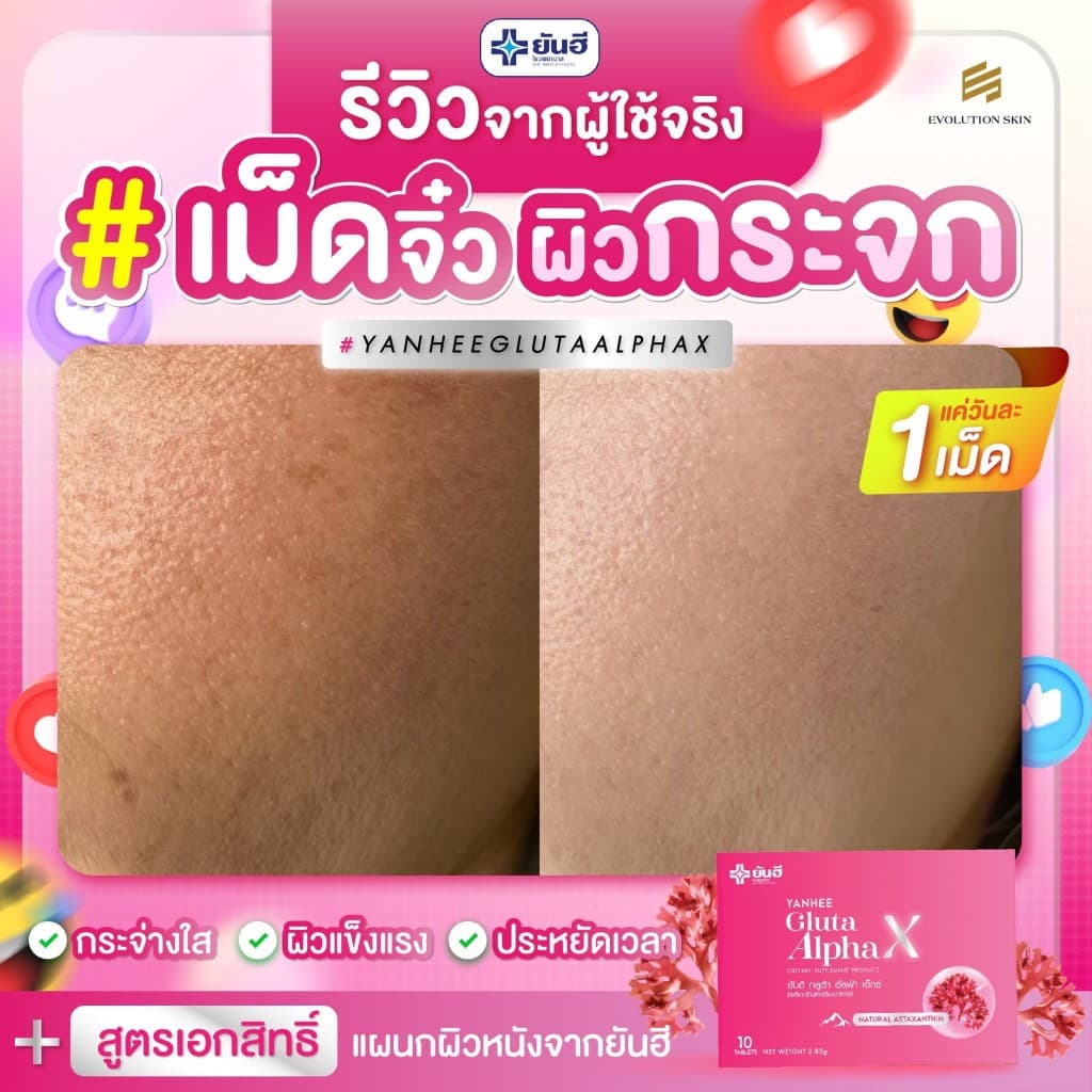YANHEE Gluta AlphaX ยันฮีกลูต้า อัลฟ่า เอ็กซ์ วิตามินผิว ช่วยปรับผิวขาวใส ออร่า ลดจุดด่างดำ ฝ้า กระ รูปที่ 8
