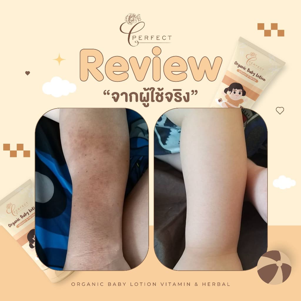 PERFECT โลชั่นเด็กออร์แกนิค บำรุงผิวขาวกระจ่างใส แก้ขาลาย ลดรอยยุงกัด กู้ผิวคล้ำเสีย รูปที่ 7