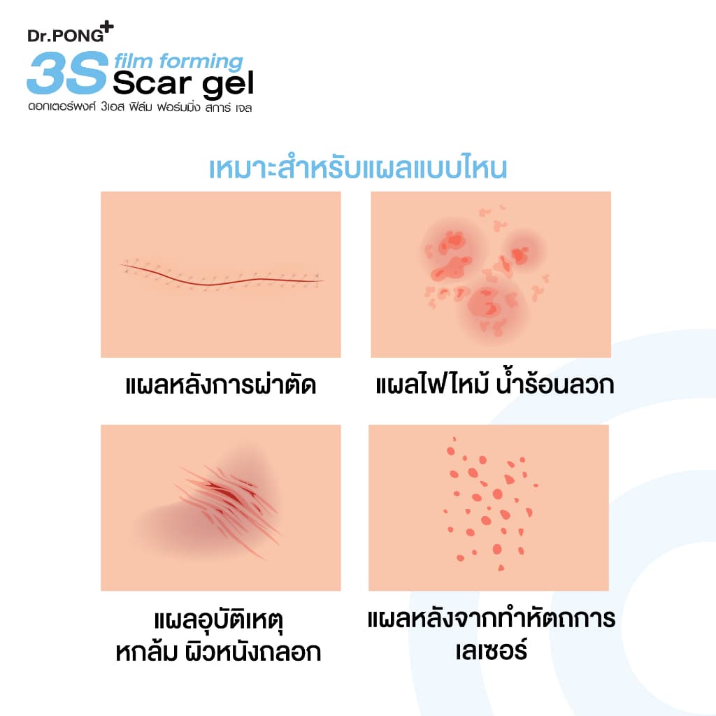 Dr.PONG 3S film forming scar gel เจลซิลิโคนทางการแพทย์ ป้องกันรอยแผลเป็น รูปที่ 7