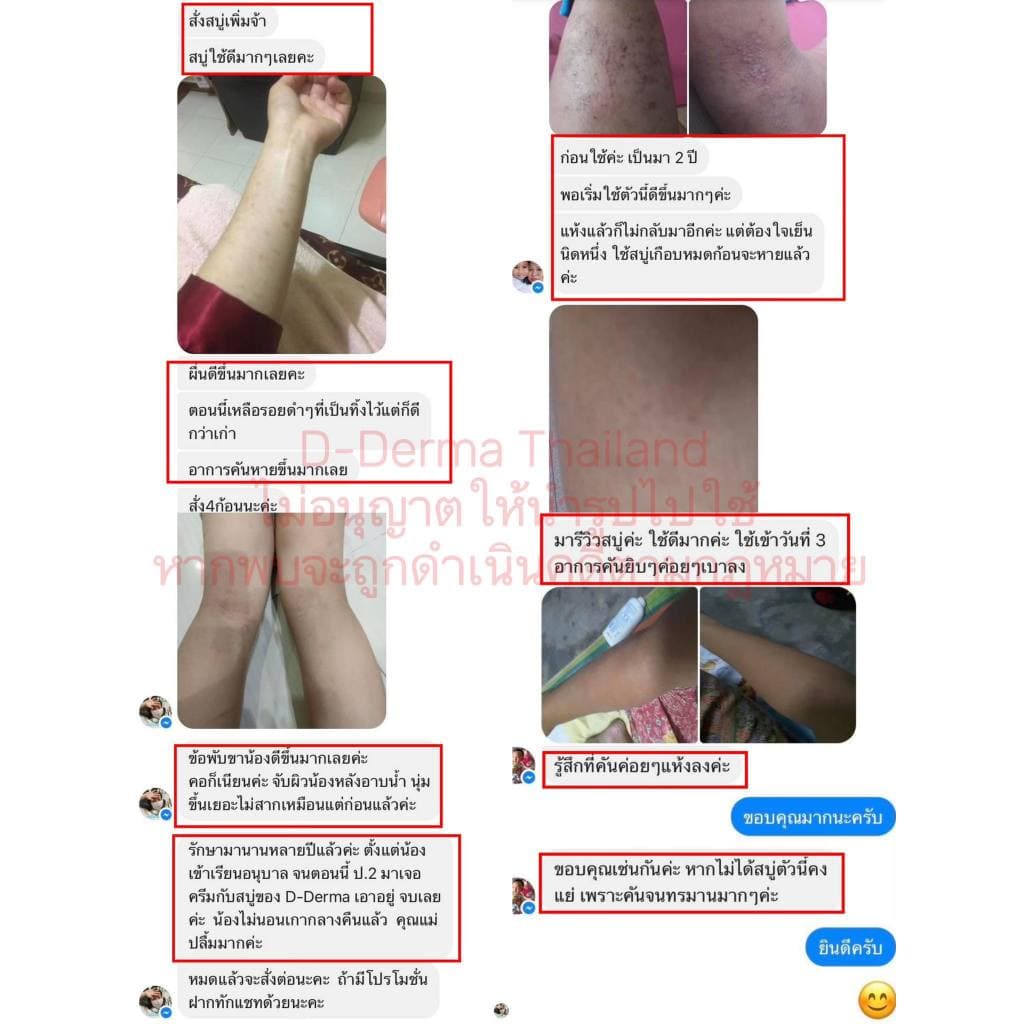D-Derma สบู่ว่าน1 และครีมว่าน 1 การคัน ผดผื่น อาการแพ้ ผิวหนังอักเสบ กลากเกลื้อน เชื้อรา เซ็บเดิร์ม รูปที่ 2