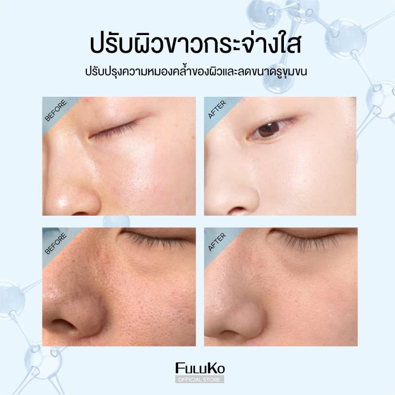 FULUKO Nicotinamide มาสก์โคลน 7.5g*8/BOX สกินแคร์ ความชุ่มชื้น ใบหน้าที่สะอาด ผิวขาว หน้าเนียนนุ่มขึ้นทันทีห รูปที่ 6