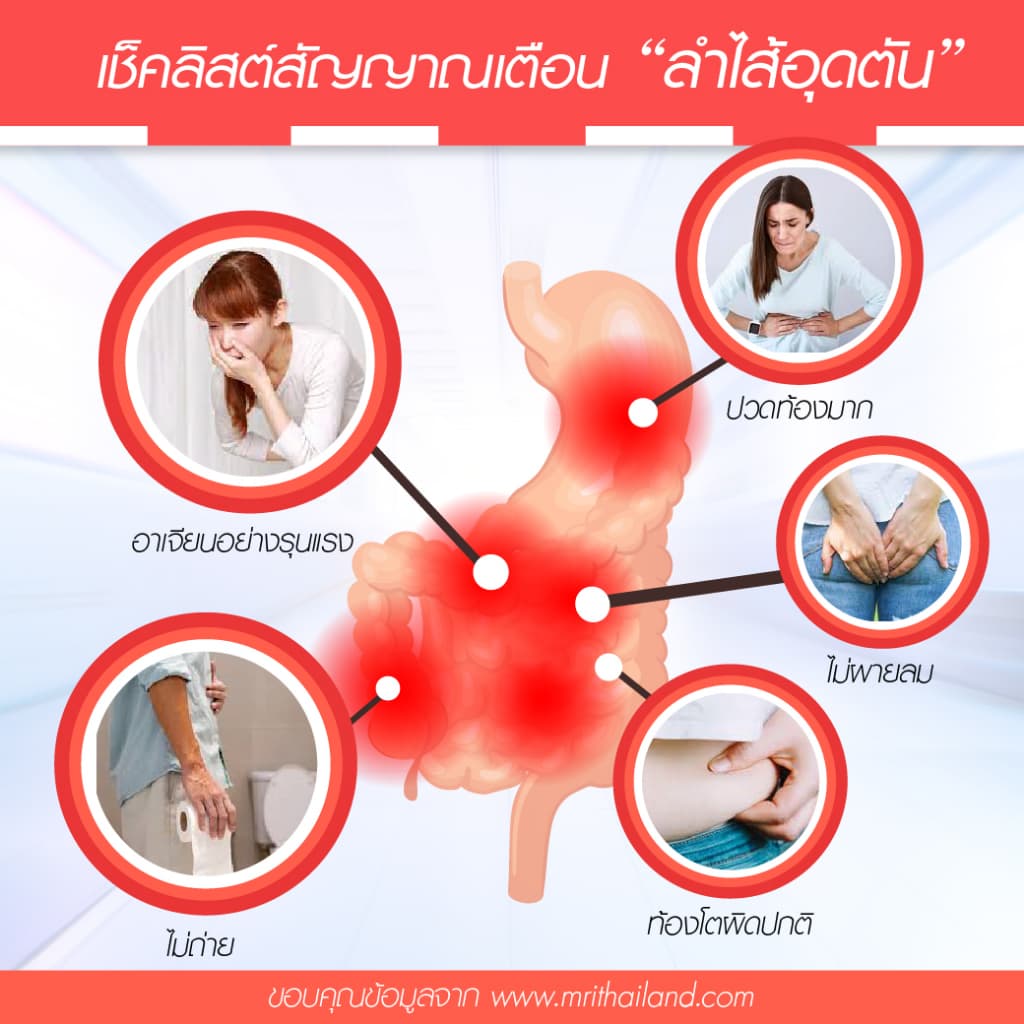 Donutt Brand ดีท็อกซ์ โพรไบโอติกส์ โทเทิลไฟบีลี่ พลัสโพรไบโอติกส์ กลิ่นเสาวรส 3 กล่อง รูปที่ 6