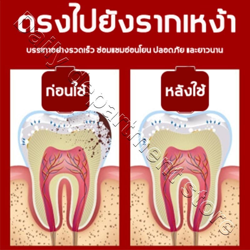 YIMIWEILAI แก้ปวดฟัน เหงือกอักเสบ ใช้หมดก็เห็นผล ช่วยลดอาการเจ็บฟันได้เป็นอย่างดี สเปรย์พ่นคอ ปวดฟัน สเปรย์แก้ปวดฟัน รูปที่ 5