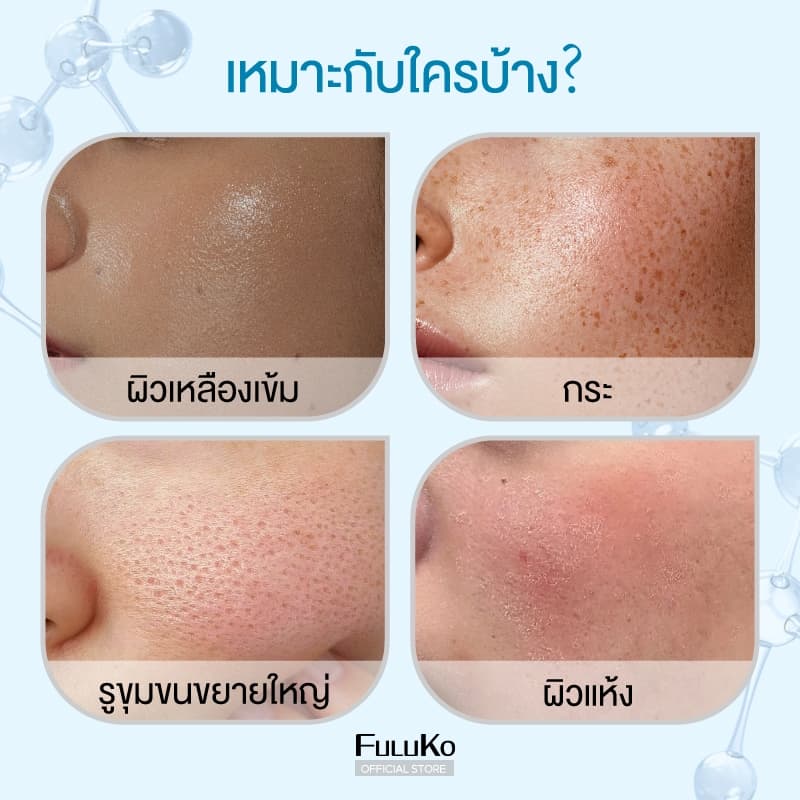 FULUKO Nicotinamide มาสก์โคลน 7.5g*8/BOX สกินแคร์ ความชุ่มชื้น ใบหน้าที่สะอาด ผิวขาว หน้าเนียนนุ่มขึ้นทันทีห รูปที่ 5