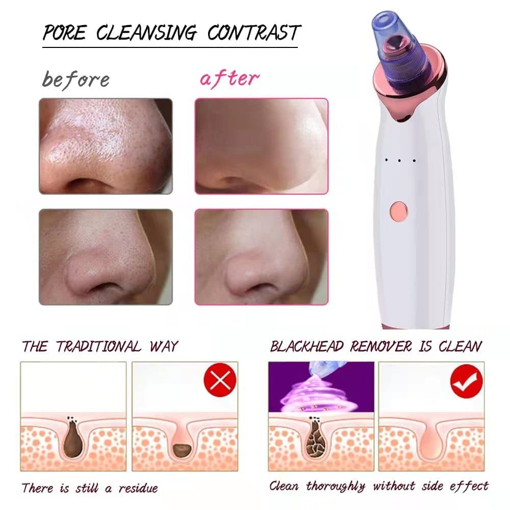 เครื่องดูดสิวเสี้ยน เครื่องดูดสิวเสี้ยนอเนกประสงค์ ดูดสิวเสี้ยนได้อย่างมีประสิทธิภาพ รูปที่ 9