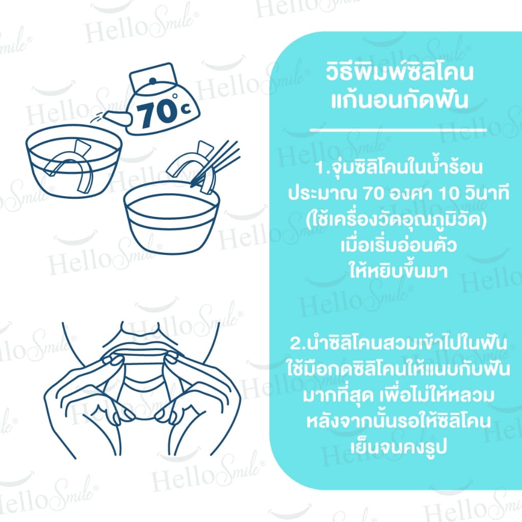 Hellosmile Dental Guards ฮัลโหลสมาย ซิลิโคนกัดฟัน ลดกัดฟัน พร้อมกล่อง แบบใส หลับง่าย ใส่สบาย รูปที่ 5