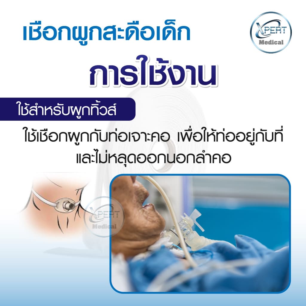 เชือกผูกสะดือ ผูกทิ้วส์ หลอดทดลอง เชือกทางการแพทย์ ผู้ป่วยเจาะคอ เชือกผูกสายฟอกไต Tube wires rope รูปที่ 4