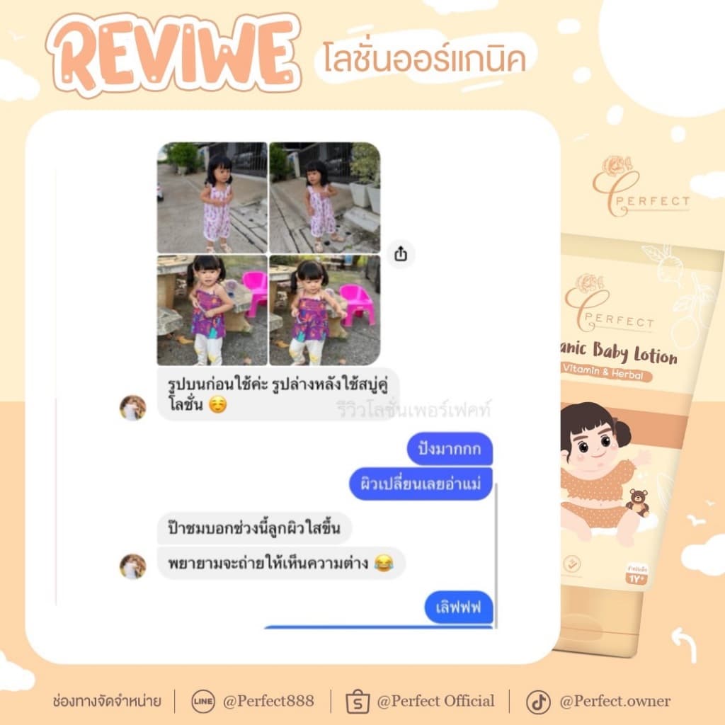 PERFECT โลชั่นเด็กออร์แกนิค บำรุงผิวขาวกระจ่างใส แก้ขาลาย ลดรอยยุงกัด กู้ผิวคล้ำเสีย รูปที่ 8