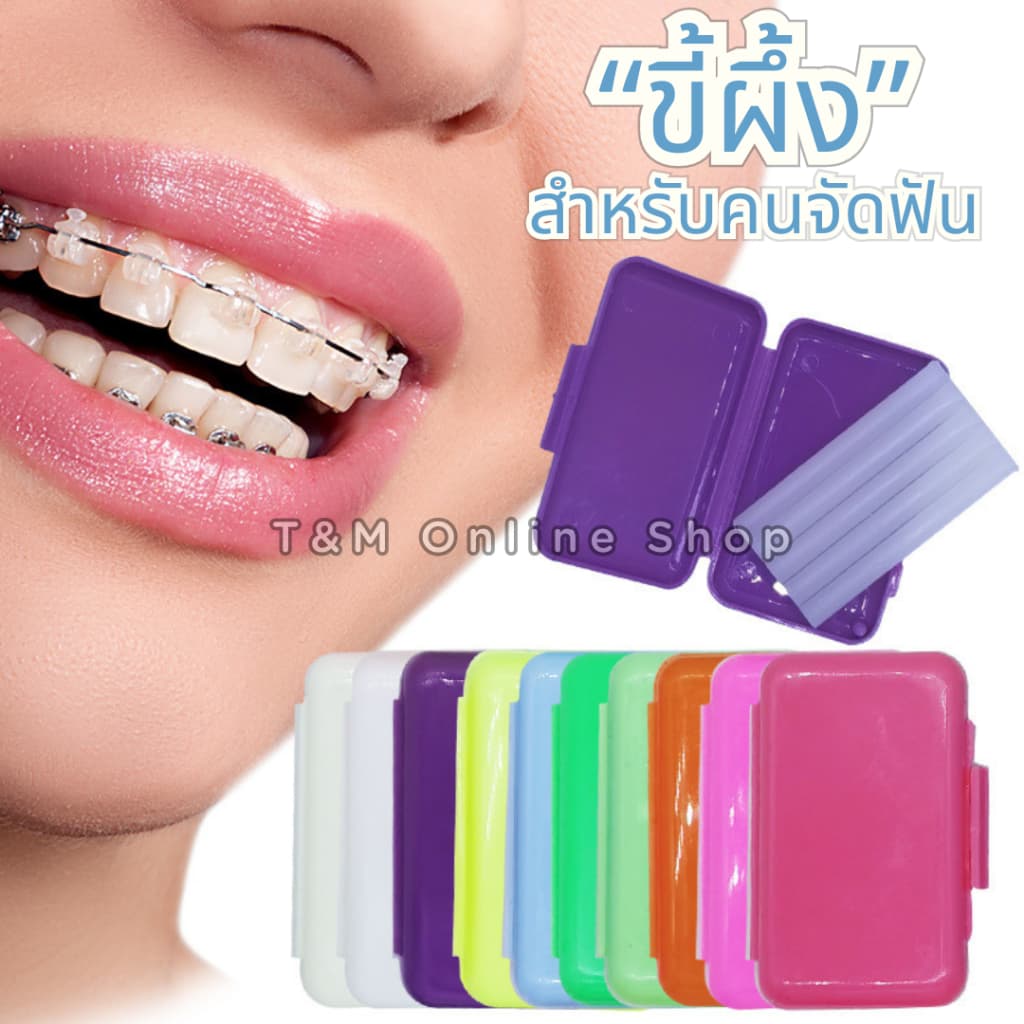 ขี้ผึ้งสำหรับคนจัดฟัน เลือกกลิ่นได้ ลดการระคายเคืองจากเครื่องมือจัดฟัน แว๊กซ์ขี้ผึ้ง 1ตลับมี5แท่ง รูปที่ 1