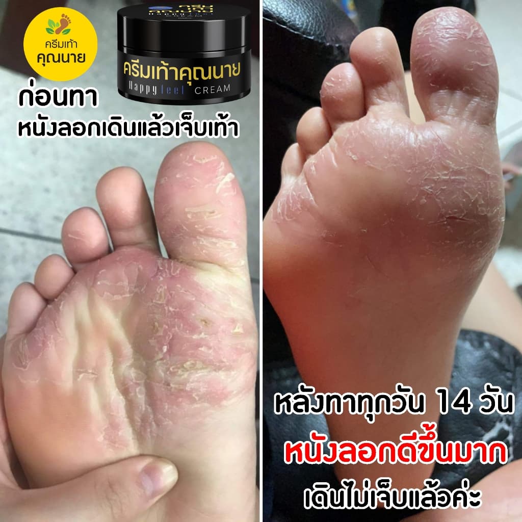 ครีมเท้าคุณนาย Happy Feet Cream ครีมเท้าขาว แพคเกจใหม่ รูปที่ 8