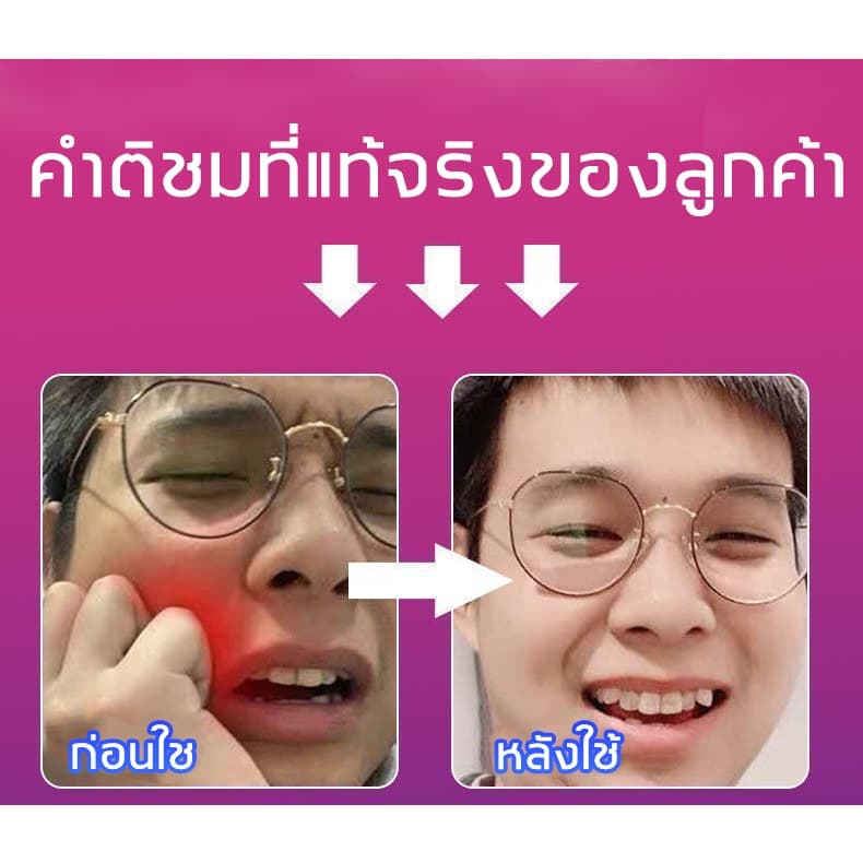 YIMIWEILAI แก้ปวดฟัน เหงือกอักเสบ ใช้หมดก็เห็นผล ช่วยลดอาการเจ็บฟันได้เป็นอย่างดี สเปรย์พ่นคอ ปวดฟัน สเปรย์แก้ปวดฟัน รูปที่ 7