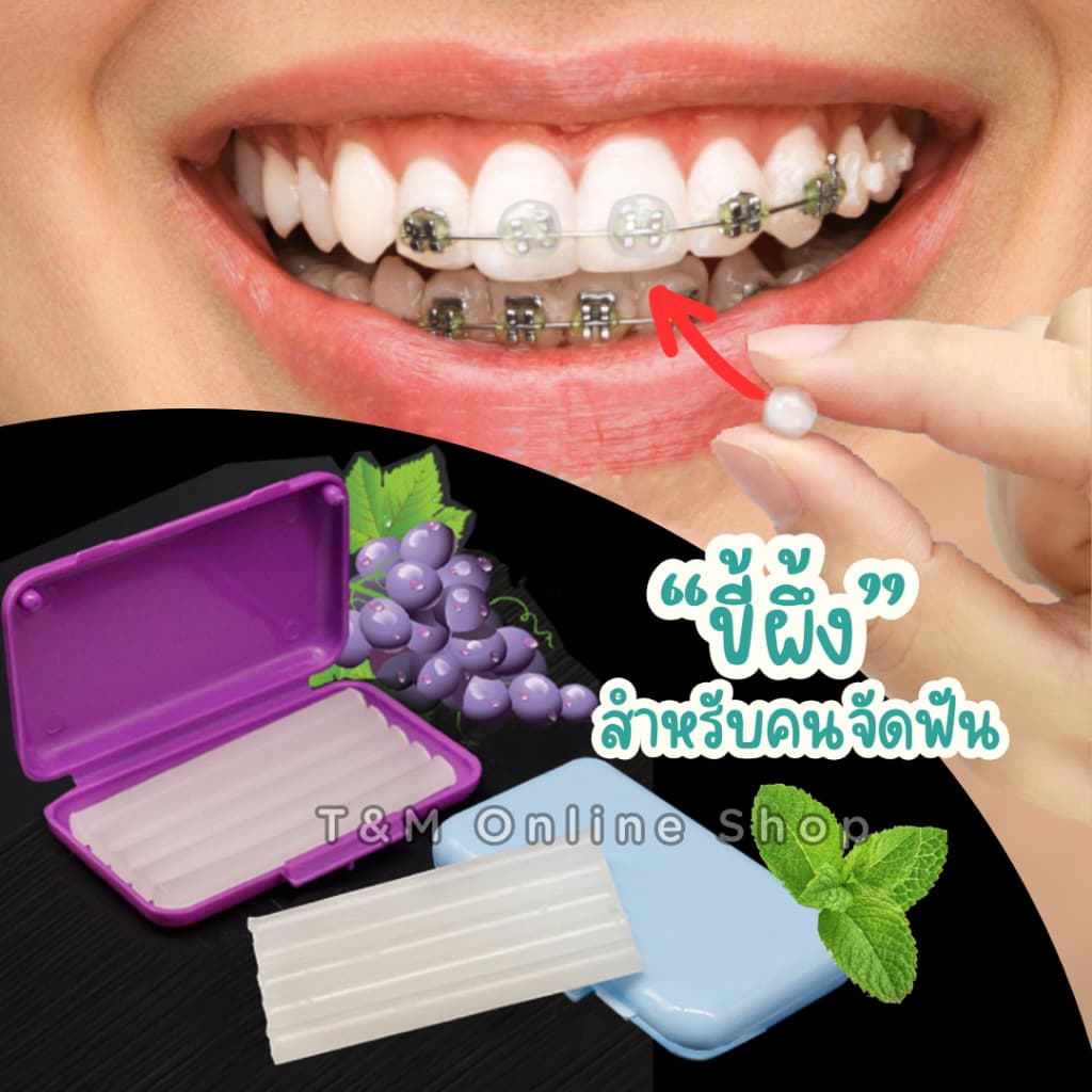 ขี้ผึ้งสำหรับคนจัดฟัน เลือกกลิ่นได้ ลดการระคายเคืองจากเครื่องมือจัดฟัน แว๊กซ์ขี้ผึ้ง 1ตลับมี5แท่ง รูปที่ 4