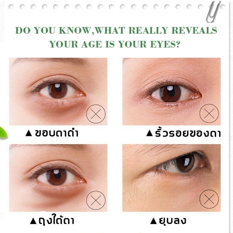 ครีมบำรุงรอบตา ครีมทาตาเม็ดไขมัน ขจัดเม็ดไขมัน 30ml ครีมกำจัดสิวข้าวสาร สิวเม็ดข้าวสาร สิวหิน ขจัดเม็ดไขม ซ่อมแซมผิว รูปที่ 3