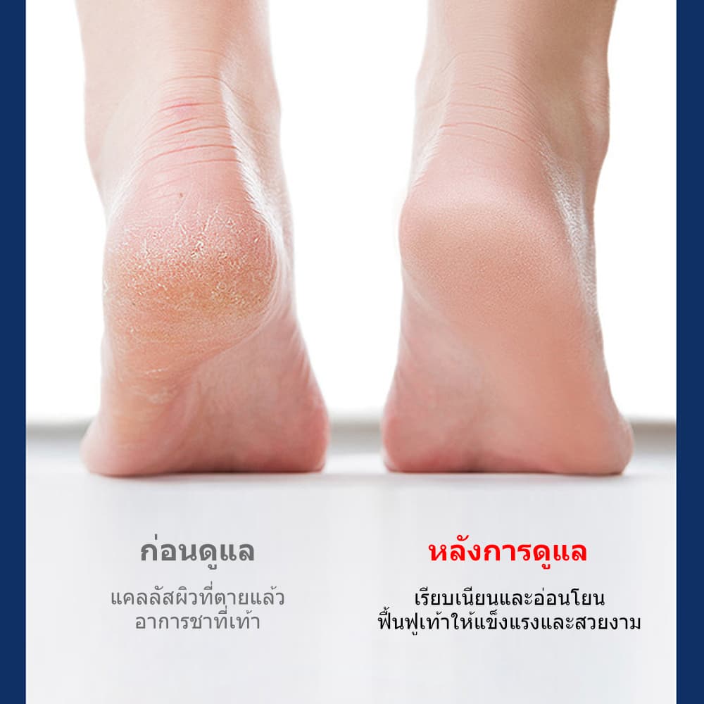 INSMART เครื่องขัดเท้า เครื่องขัดส้นเท้าไฟฟ้า กันน้ำ ที่ขัดเท้าไฟฟ้า ขัดเซลล์ผิวที่ตายเเล้ว รูปที่ 2