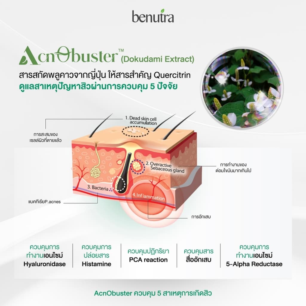 Benutra Acno Pro บีนูทร่า แอคโน โปร วิตามินลดสิว ซิงค์ลดสิว สิวอักเสบ ลดรอยสิว คุมมัน 1 กล่อง30เม็ด รูปที่ 4