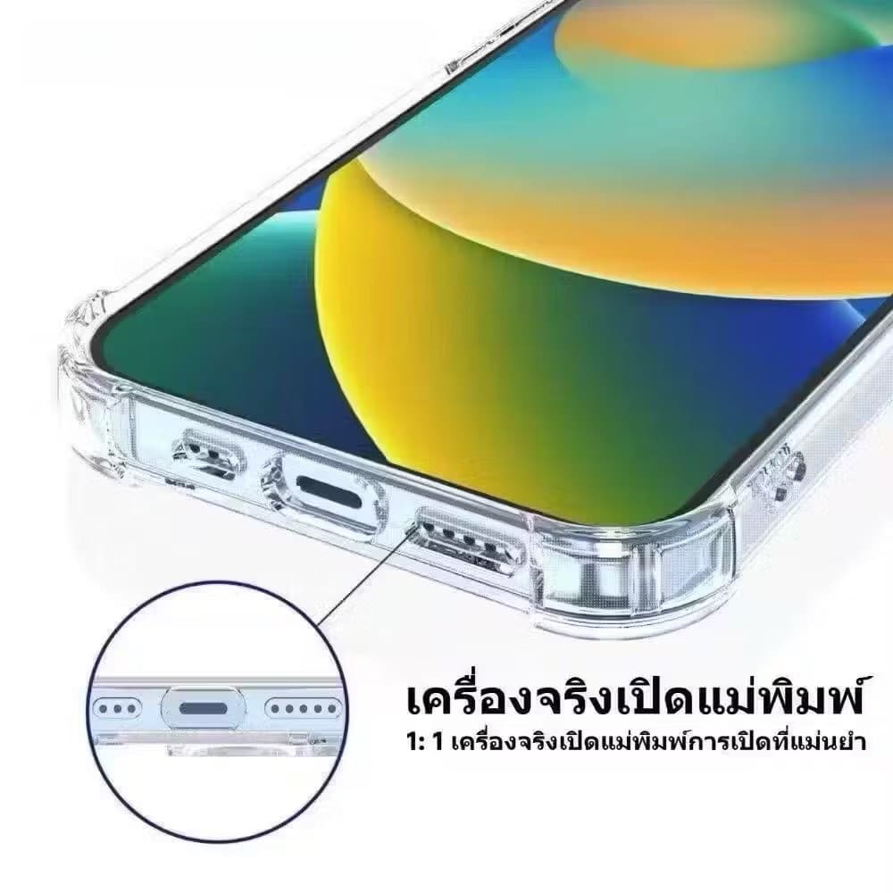 เคสใสแข็ง สำหรับ Vivo V40 V40pro V30 V30E V30pro V29 V29E V27 V27pro V25 V25pro V23 V23E เคสคิงคอง เคสใสกันกระแทก รูปที่ 5