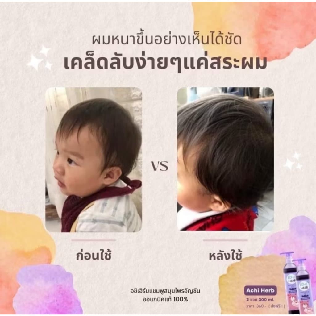 ส่งด่วน Achi Herb shampoo อชิเฮิร์บ แชมพูสมุนไพรอัญชัน เร่งผมยาว บำรุงผมให้ดกดำ รูปที่ 8