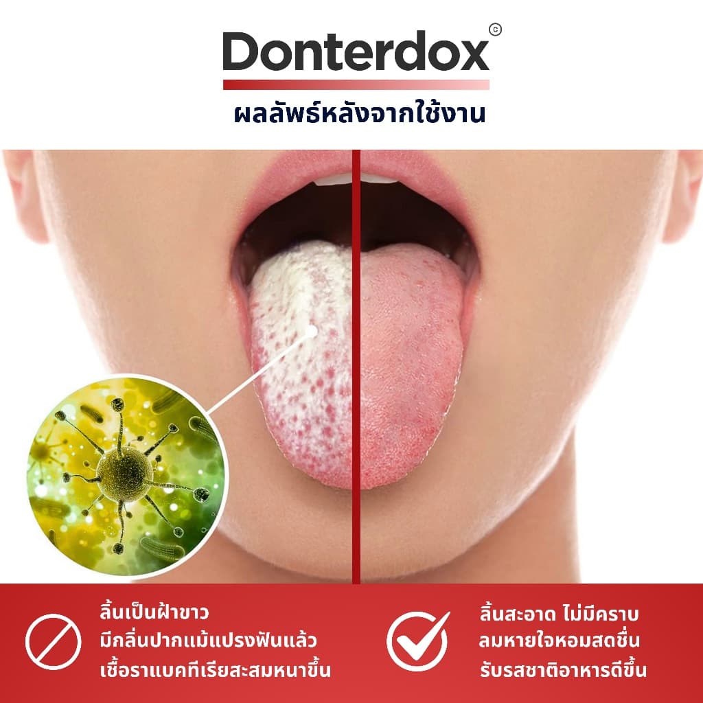 Donterdox - ที่ขูดลิ้นสแตนเลสทรง U-Shape แปรงทำความสะอาดลิ้น ขจัดกลิ่นปาก ทำความสะอาดอย่างทั่วถึง รูปที่ 4