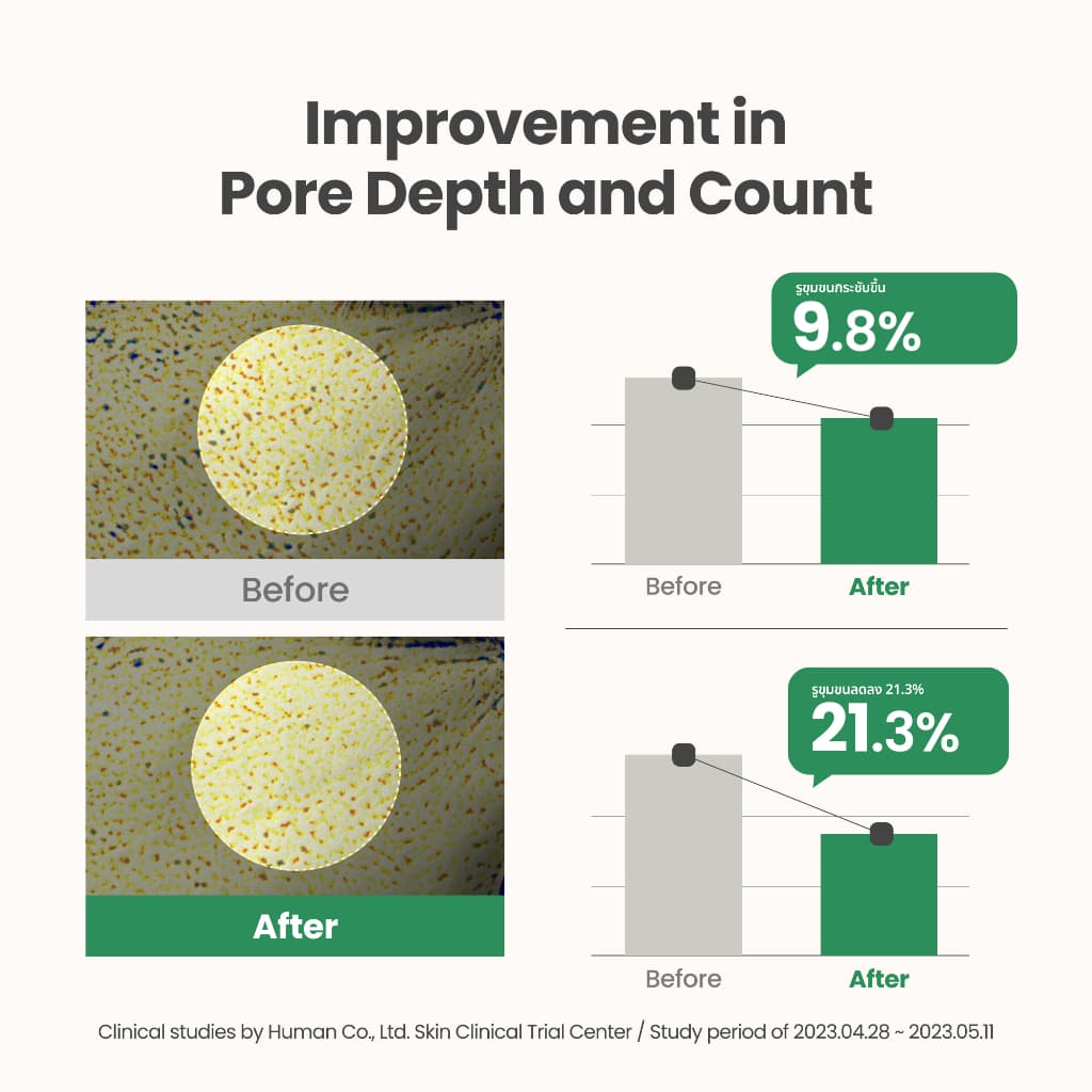 AXIS-Y Mugwort Pore Clarifying Wash Off Pack มักเวิร์ด พอร์ คลาริฟายอิ้ง วอช ออฟ แพ็ค รูปที่ 5