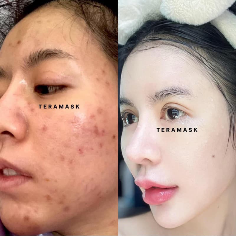 วิตามินหน้าใส เทร่ามาส์ก มาส์กบำรุง กลางคืน Teramask รูปที่ 8