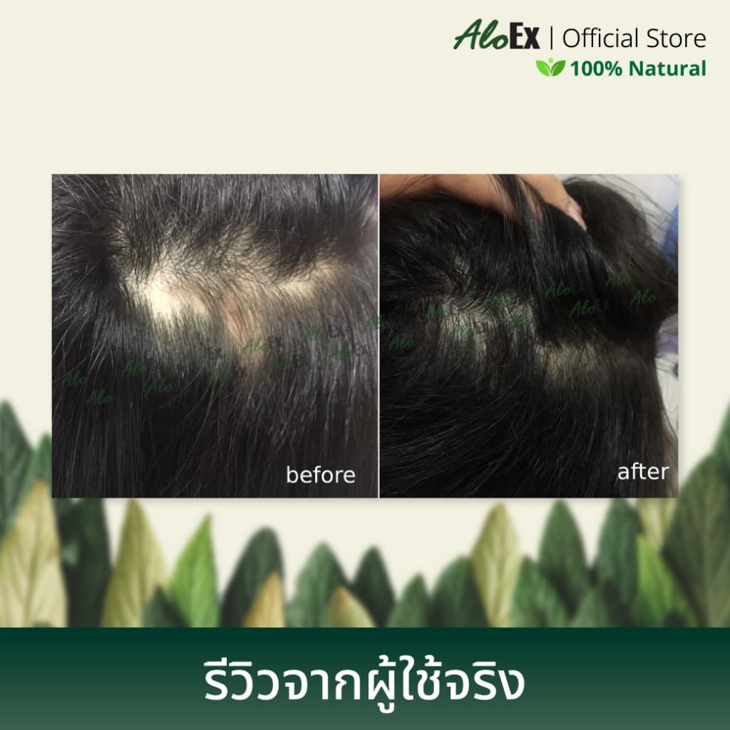 AloEx Hair Serum 50 ml. เซรั่มบำรุงหนังศีรษะและเส้นผม ลดผมร่วง สร้างผมใหม่ รากผมแข็งแรง เพิ่มผมหนา รูปที่ 6