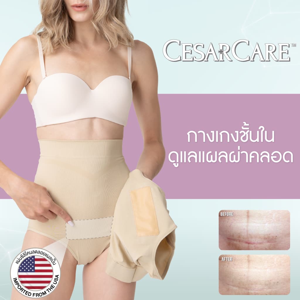 Ministry of Mama - CesarCare Nude ชั้นในดูแลแผลผ่าคลอด สีครีม รูปที่ 1
