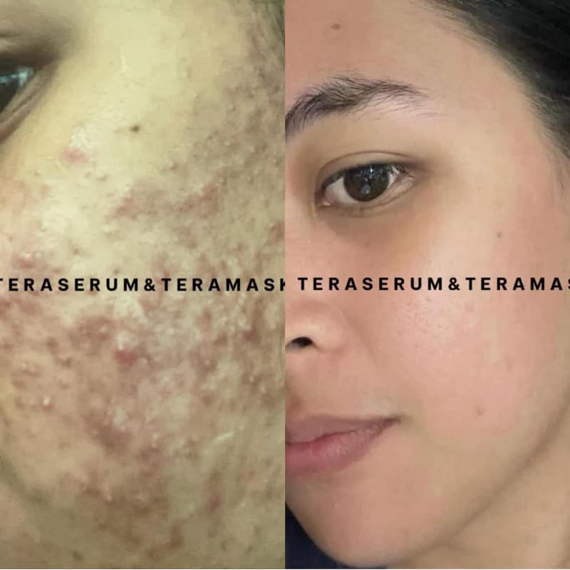 วิตามินหน้าใส เทร่ามาส์ก มาส์กบำรุง กลางคืน Teramask รูปที่ 9