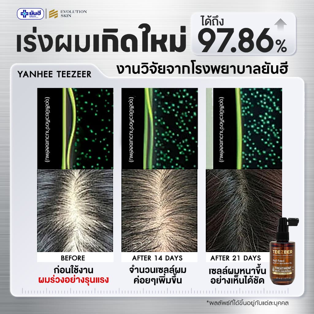 YANHEE TEEZEER ยันฮีทีเซอร์เซรั่ม เซรั่มปลูกผม 1 ขวด 60 ml ลดผมร่วง ปิดผมบาง ชะลอผมหงอก เร่งผมยาว ผมดกดำ รูปที่ 4
