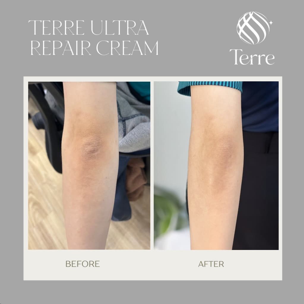 Terre Ultra Repair Cream เทอร์เร่อัลตรารีแพร์ครีม สูตรเข้มข้น สำหรับเท้า มือ ศอก เข่า 120 มล. รูปที่ 7
