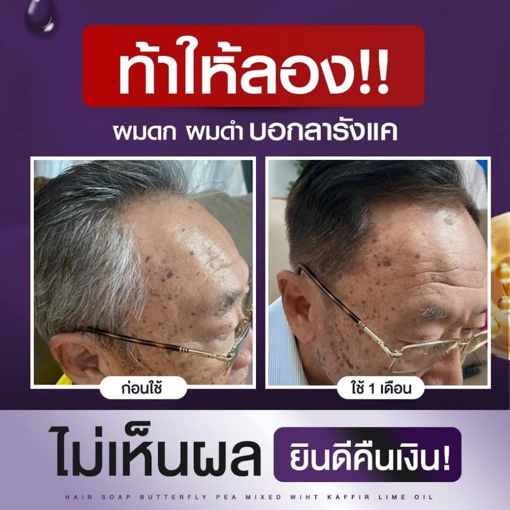โปร 10 ก้อน สบู่อัญชัญและน้ำมันมะกรูด รักษารากผม ผมดกดำ รูปที่ 6