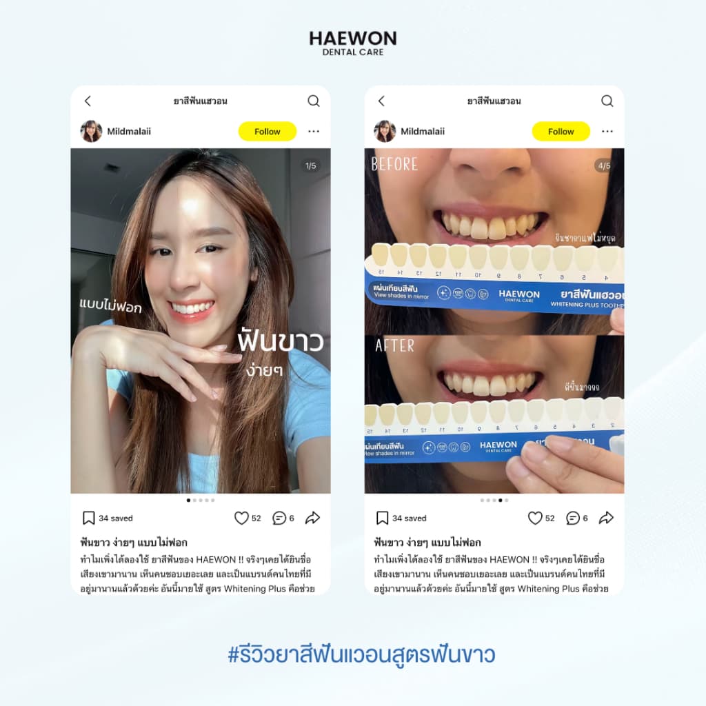 Haewon Whitening Plus 80g ยาสีฟันแฮวอน สีฟ้าฟันขาว ไม่ต้องฟอก ไม่ทำลายสารเคลือบฟัน ฟลูออไรด์ 1500ppm รูปที่ 7