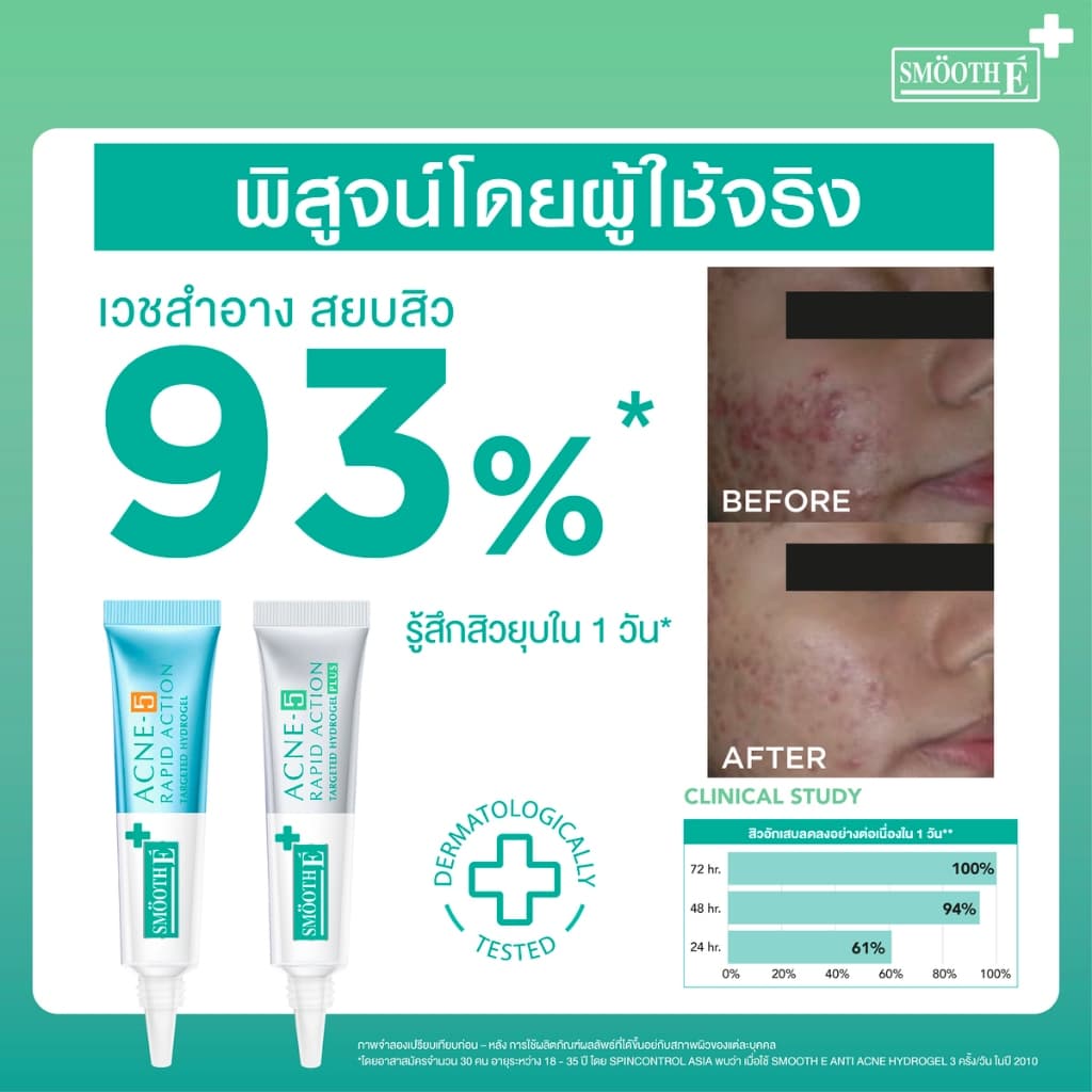 Smooth E Acne Hydrogel plus Acne-5 Rapid Action Sensitive 4% 0%steroid #768 รูปที่ 7
