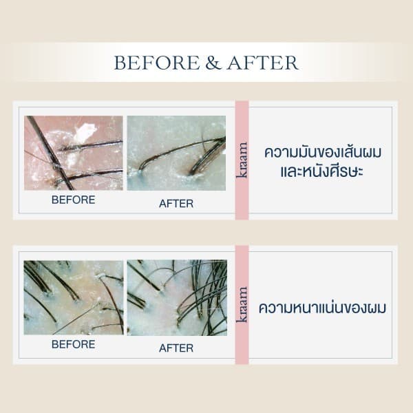 Kraam Hair&Scalp Detoxifying Shampoo รูปที่ 7