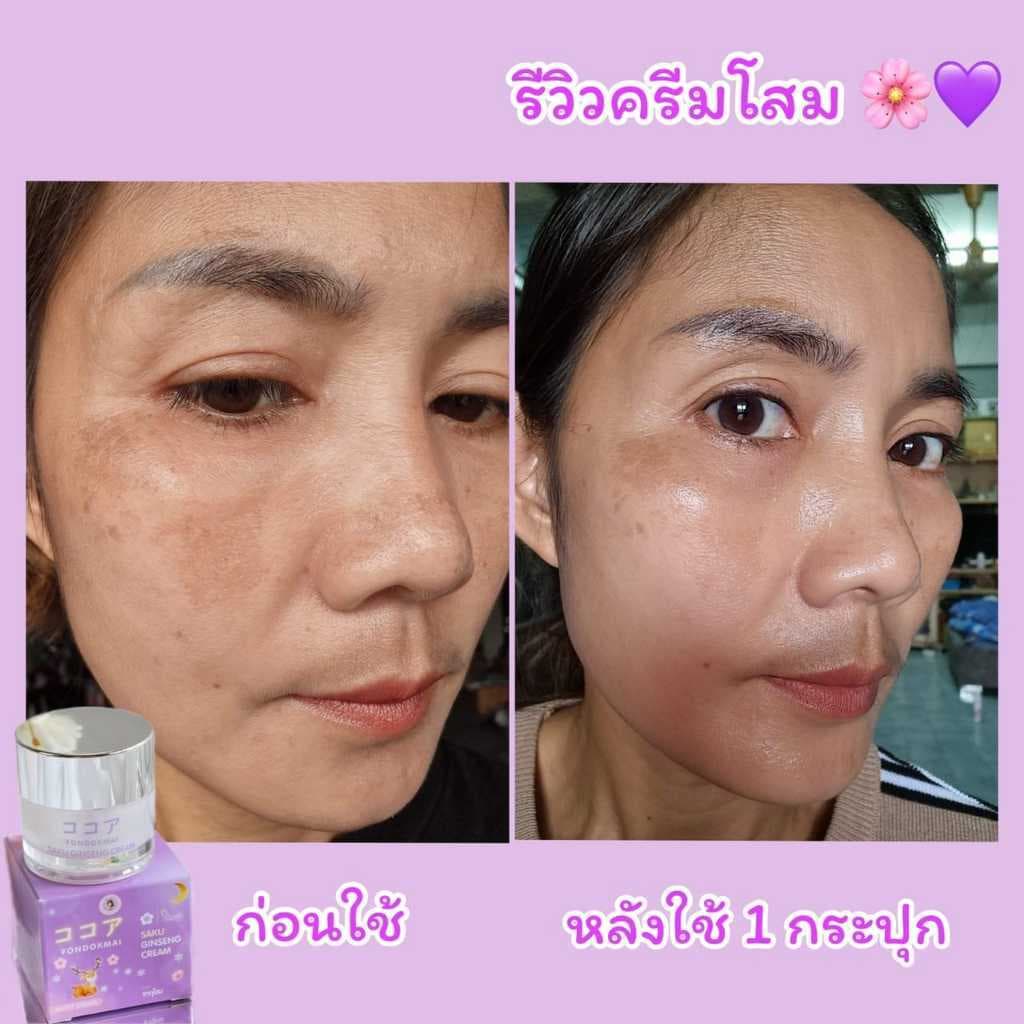ฝนดอกไม้ ครีมโสมซากุ 3แถม2 รูปที่ 5