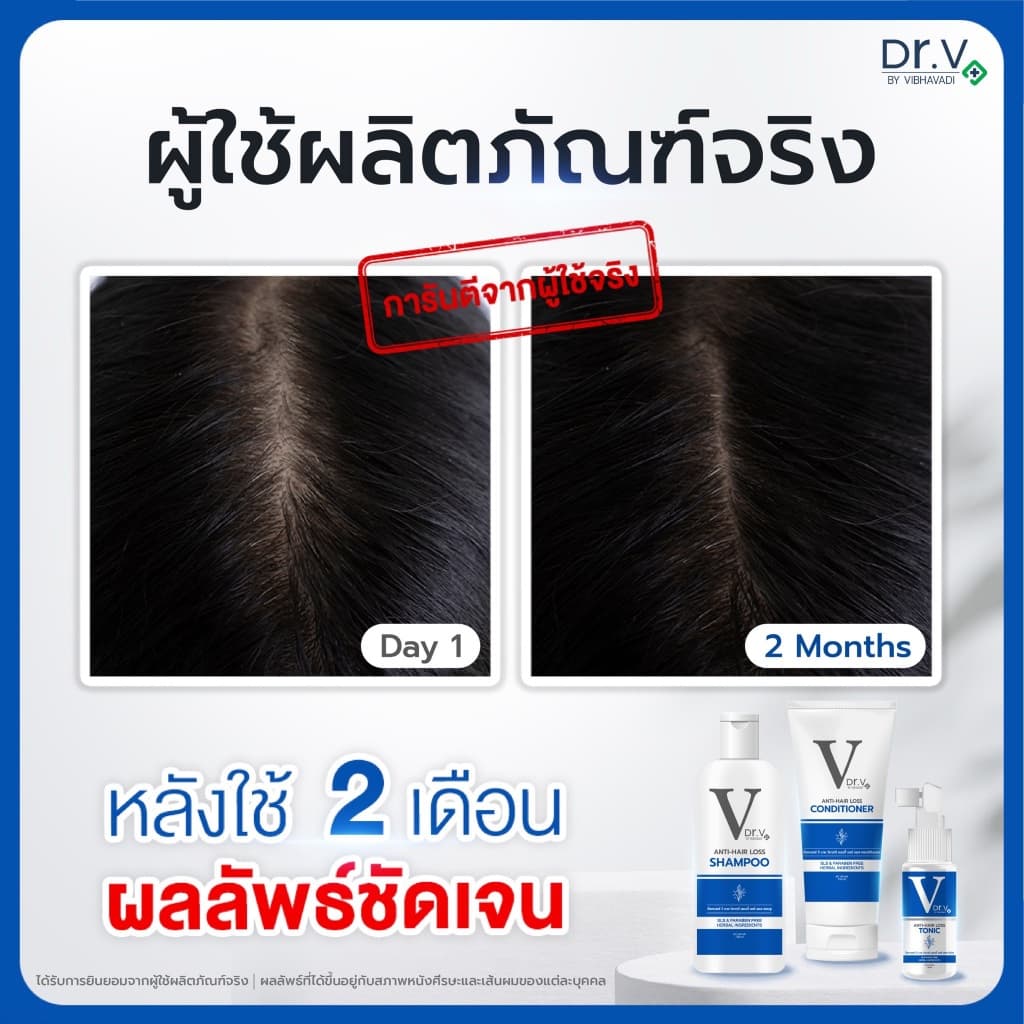 แชมพูสระผมลดผมร่วง บำรุงเส้นผมและหนังศีรษะ Dr.V Shampoo รูปที่ 6