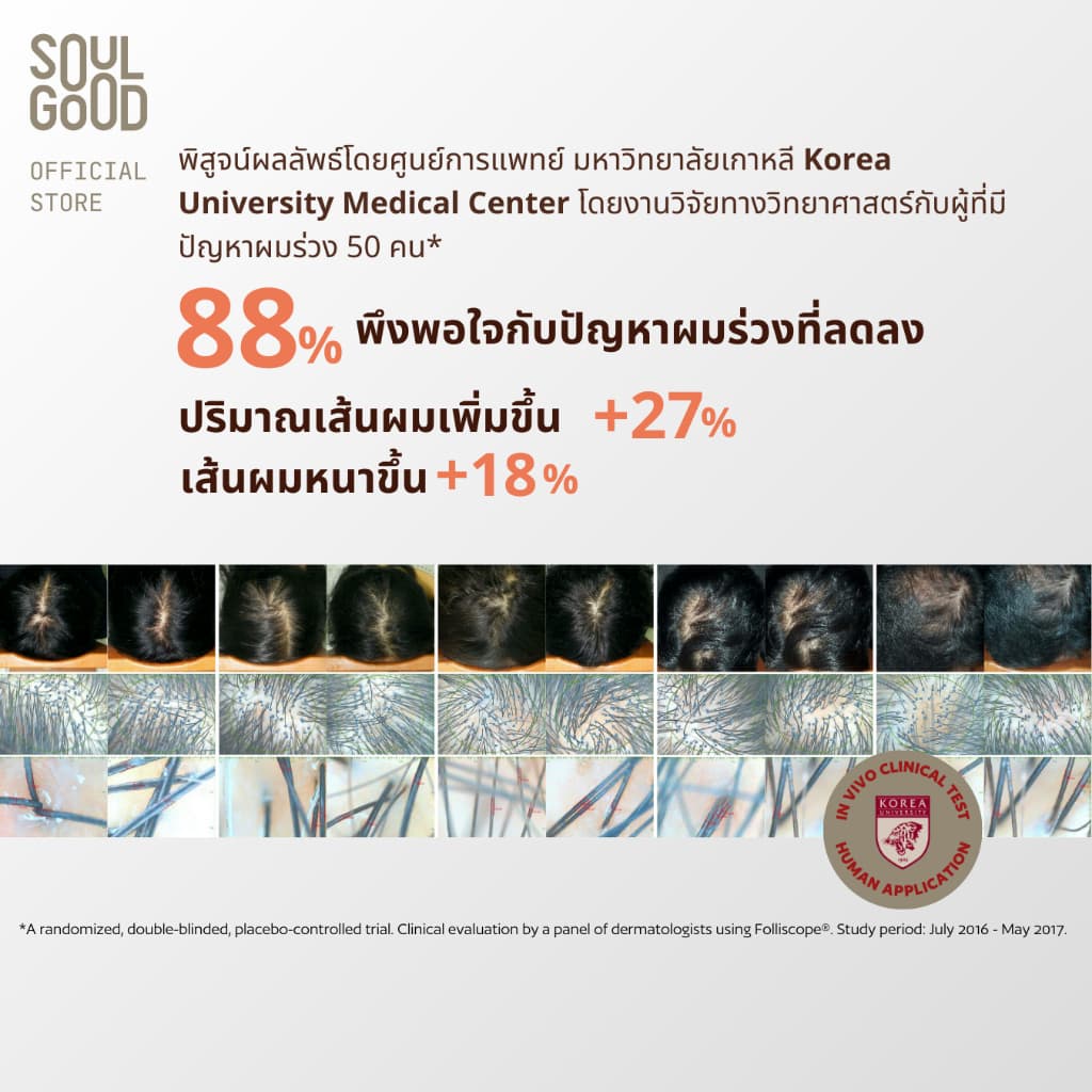 SoulGood ProbioBeer Anti Hair Loss Sensitive Scalp Shampoo 300mlx2 โซลกู๊ดแชมพูเบียร์ รูปที่ 5