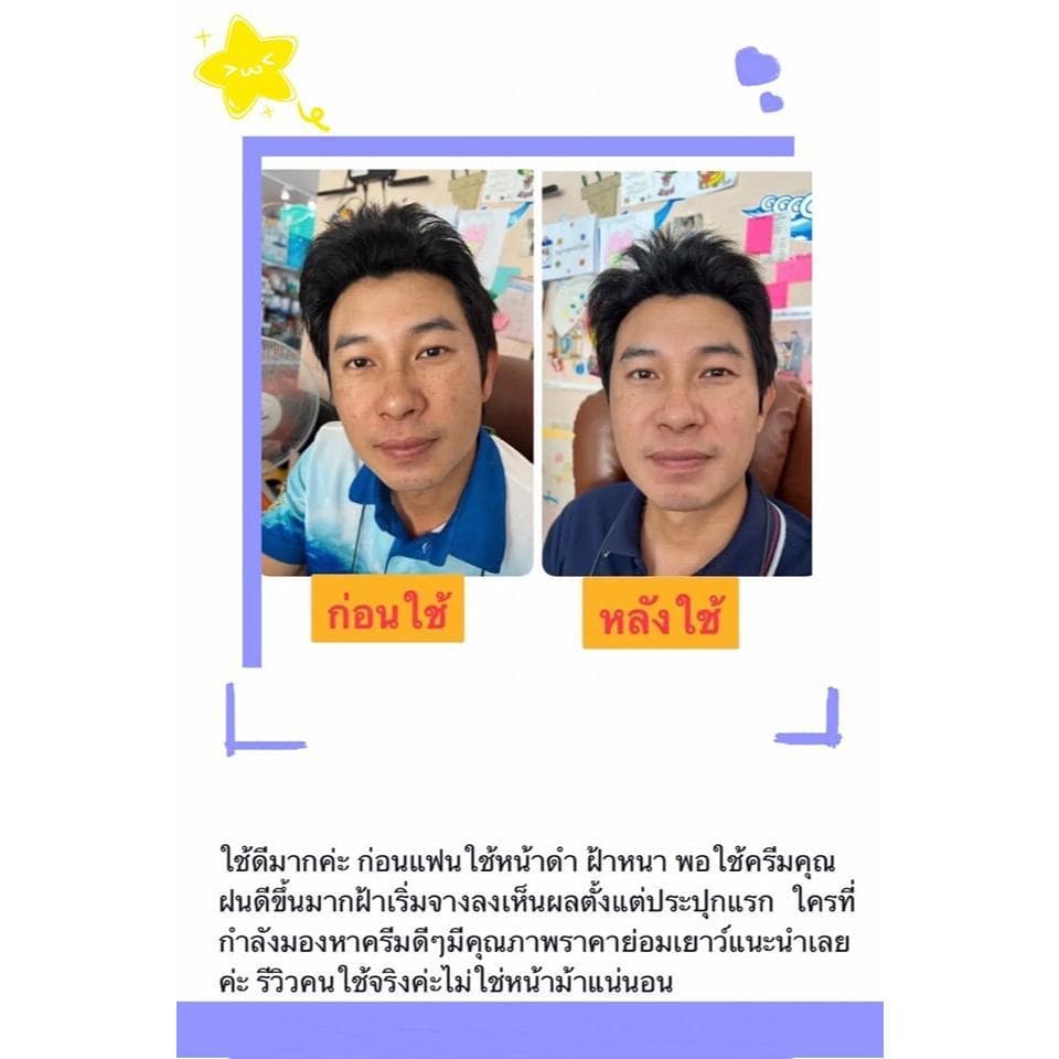 ฝนดอกไม้ ครีมโสมซากุ 3แถม2 รูปที่ 6