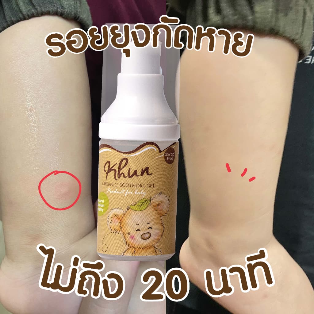 KHUN เจลทากันยุงกัด ลดบวม ไม่ทิ้งรอยดำ สูตรออร์แกนิค อ่อนโยน สำหรับเด็ก รูปที่ 8
