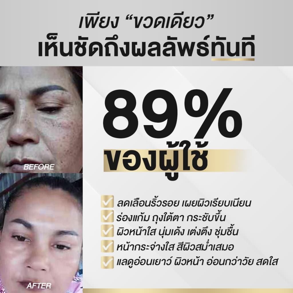 นิสิตซีจี NISIT CG เซรั่มขวดทอง “กิ๊ก สุวัจนี” เซรั่มเพื่อคนไม่ยอมแก่ นิสิต CG รูปที่ 8