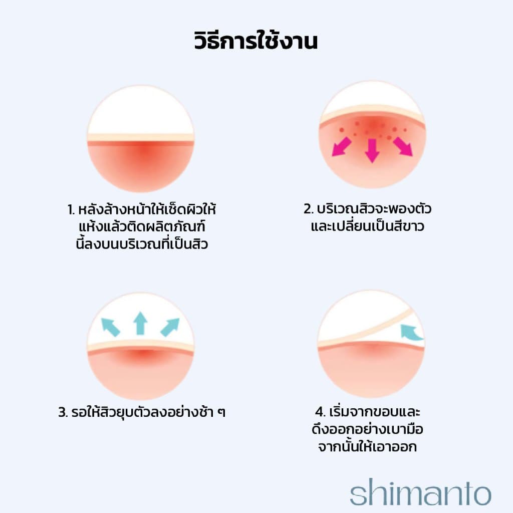 Shimanto แท้ แผ่นแปะสิว กันน้ำกันเหงื่อ ไม่มันเงา ผิวแพ้ง่ายใช้ได้ รักษาและปกปิดสิวอักเสบ รูปที่ 3