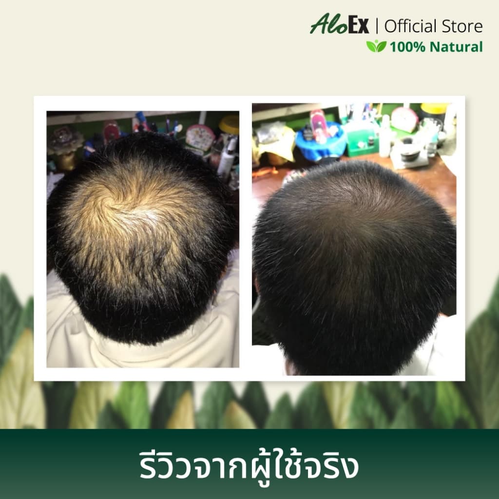 AloEx Hair Serum 50 ml. เซรั่มบำรุงหนังศีรษะและเส้นผม ลดผมร่วง สร้างผมใหม่ รากผมแข็งแรง เพิ่มผมหนา รูปที่ 5
